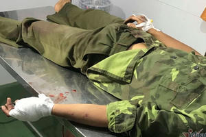 Bị phát hiện cắt trộm gỗ, hơn 20 lâm tặc vây chém đứt gân tay kiểm lâm