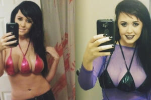 Từng khiến cả thế giới sốc vì có 3 bầu ngực, cô gái đưa ra quyết định bất ngờ sau 6 năm