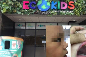 Cận cảnh Trường mầm non Ecokids nơi bé trai 3 tuổi bị cô giáo đánh tím mặt, tụ máu môi