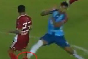 [Clip]: Gãy đôi chân do pha đạp gầm giày ác ý của đối thủ