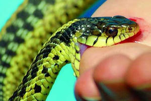 Bác sĩ lưu ý cách xử trí khi bị rắn cắn