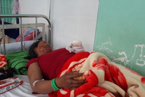 Vụ nổ đầu đạn pháo 9 người bị thương: Bé gái 22 tháng tuổi đang nguy kịch