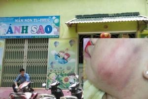 Thời sự 9h sáng ngày 28/5/2016: Đình chỉ cơ sở mầm non Ánh Sao để công an điều tra