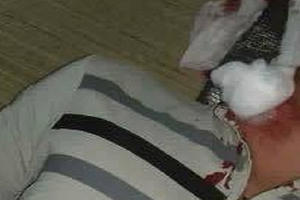 Hòa Bình: Đang nằm xem điện thoại trong nhà, một người nghi bị đạn rơi trúng cổ