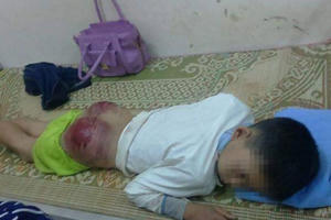 Cộng đồng mạng phẫn nộ với người cha đánh con dã man