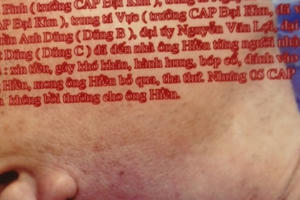 Lãnh đạo doanh nghiệp "tố" bị công an phường đánh: Thương tật ở tai, giám định 0%