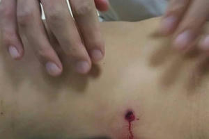 Vụ nhóm thanh niên nổ súng ở Xuân La: Một phụ nữ bị trúng đạn