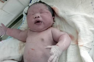 Vĩnh Phúc: Bé trai vừa sinh đã nặng 7,1kg
