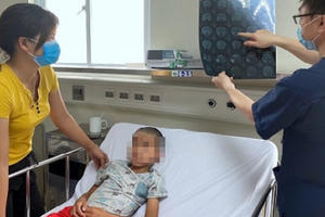 Bác sĩ BV Nhi TW khuyến cáo: Nắng nóng gia tăng các ca mắc viêm não ở trẻ nhỏ