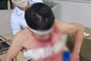 Gia chủ bị chém trọng thương ngay tại nhà của mình