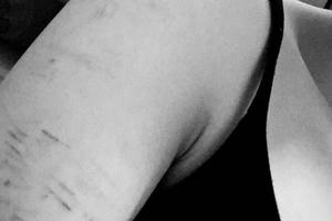 Giật mình người trẻ rạch tay, uống thuốc ngủ... trong mùa Giáng sinh