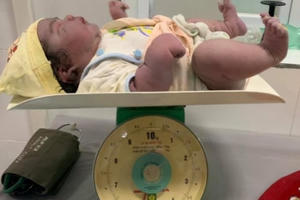 Sản phụ lập kỳ tích trong ngày 20/10, khi sinh thường một bé gái nặng đến 5,5 kg