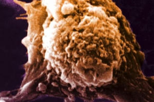 Mã hoá kháng nguyên - Đột phá mới trong nghiên cứu vắc xin ung thư Mã hoá kháng nguyên - Đột phá mới trong nghiên cứu vắc xin ung thư