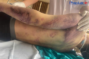 Tâm sự uất nghẹn của người bố có con bị đánh tử vong tại Trung tâm Công tác xã hội Hải Hà