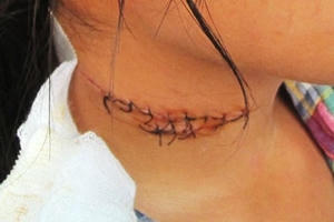 Đà Nẵng: Chồng cứa cổ vợ rồi tự sát, cả hai thoát chết