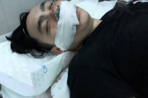 Hà Nội: Đi ăn liên hoan, thanh niên bị nhóm đối tượng chém suýt chết trước cửa quán karaoke