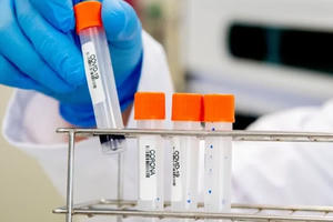 Tín hiệu tích cực từ tâm dịch biến thể Omicron