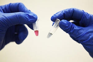 Australia phát hiện phương pháp chẩn đoán ung thư chỉ trong 10 phút