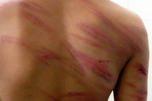 Bắt giam cha dượng bạo hành con riêng của vợ