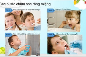 Chăm sóc răng miệng không đúng cách hậu quả khó lường