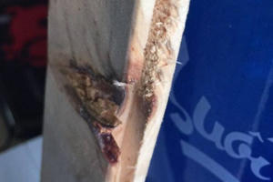 Quảng Ninh: Nhân viên nhà hàng bị khách dùng súng bắn ngay tại quán