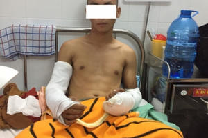 TP HCM: Kinh hoàng - đang uống cà phê bị nhóm người truy sát chém cụt tay