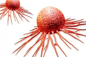 Mỗi năm Việt Nam có hơn 126.000 ca mắc ung thư mới Mỗi năm Việt Nam có hơn 126.000 ca mắc ung thư mới