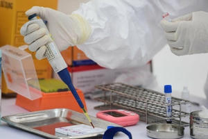 CDC Hà Nội mua máy xét nghiệm Covid-19 tới 7 tỷ đồng, trong khi giá nhập chỉ 2,3 tỷ đồng