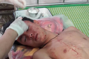 Khởi tố nhóm thanh niên lao xe máy vào trường học đánh thầy và trò nhập viện