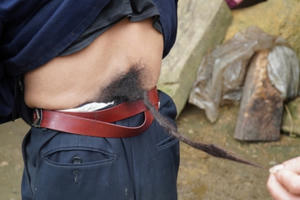 Video phóng sự: Chuyện đời của “người đàn ông mọc đuôi" ở Hà Giang