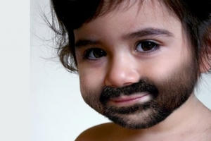 “Sốc” bé trai 1 tuổi phát triển sớm bất thường như nam giới trưởng thành