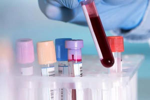 Bộ Y tế đã cấp phép cho 86 đơn vị được thực hiện xét nghiệm khẳng định COVID-19