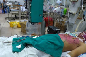 Tự mua thuốc điều trị thủy đậu, nam thanh niên 28 tuổi nguy kịch Tự mua thuốc điều trị thủy đậu, nam thanh niên 28 tuổi nguy kịch