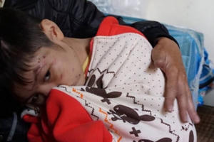 Điểm báo ngày 8/12/2017: Người lớn mất kiểm soát, con trẻ thành “cá nằm trên thớt”