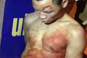 Hà Nội: Nam thanh niên đâm thủng cổ tài xế taxi trong đêm