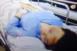 Mức án nào dành cho kẻ tạt axit nữ sinh tại Gò Vấp?