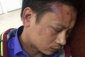 Bảo vệ Bệnh viện đánh người nhà bệnh nhân đối mặt mức án nào?