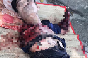 Người đàn ông bị hổ cắn lìa cánh tay trong khu du lịch ở Bình Dương? Người đàn ông bị hổ cắn lìa cánh tay trong khu du lịch ở Bình Dương?