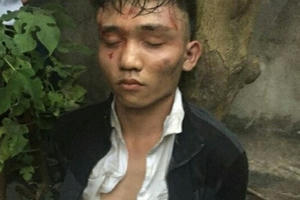 Hà Nội: Bắt "sống" đối tượng cướp giật vô cùng hung hãn