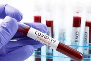 Ba người dương tính trở lại sau khi âm tính với Covid-19