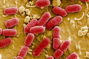 Việt Nam xuất hiện siêu vi khuẩn kháng tất cả kháng sinh