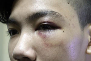 Đang đi trên đường, nhóm học sinh lớp 9 bất ngờ bị đánh vì nghi trộm chó