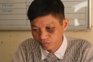 Bắc Kạn: Khởi tố đối tượng tấn công CSGT đang làm nhiệm vụ