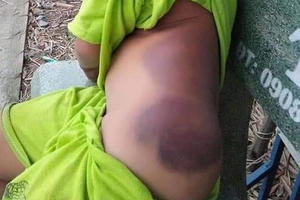 Phụ huynh cả nể 'đồng lõa' với bạo hành học đường