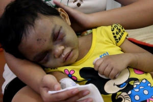 Bạo hành trẻ nhỏ ngày càng tăng: Hoang mang “gửi trứng cho ác”?