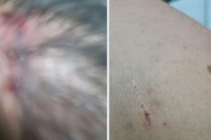 Quảng Ninh: Bị xâm phạm chỗ ở, công dân còn bị hành hung gây thương tích