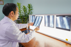 Giữ chân thành công cho bé gái 8 tuổi mắc ung thư sụn