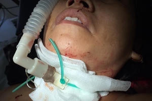 Chủ tiệm tóc bị kẻ lạ mặt xông vào cứa cổ: Có dấu hiệu hiếp dâm