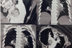 Bỗng dưng mất ý thức đột ngột, hãy đến bệnh viện ngay