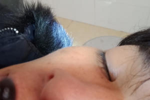 Kinh hãi phát hiện con đỉa dài 6 cm sống trong hốc mũi nam thanh niên